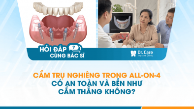 [HỎI ĐÁP BÁC SĨ]: Cắm trụ nghiêng trong All-on-4 có an toàn và bền như cắm thẳng không?