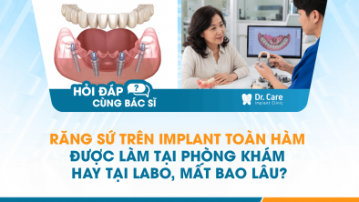[HỎI ĐÁP BÁC SĨ]: RĂNG SỨ TRÊN IMPLANT TOÀN HÀM ĐƯỢC LÀM TẠI PHÒNG KHÁM HAY TẠI LABO, MẤT BAO LÂU?
