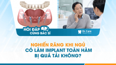 [HỎI ĐÁP BÁC SĨ]: Nghiến răng khi ngủ có làm Implant toàn hàm bị quá tải không?