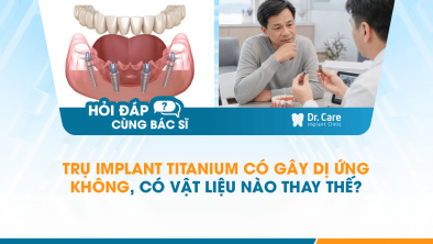 [HỎI ĐÁP BÁC SĨ]: Trụ Implant titanium có gây dị ứng không, có vật liệu nào thay thế?
