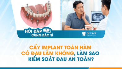 [HỎI ĐÁP BÁC SĨ]: CẤY IMPLANT TOÀN HÀM CÓ ĐAU LẮM KHÔNG, LÀM SAO KIỂM SOÁT ĐAU AN TOÀN?