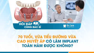 [HỎI ĐÁP BÁC SĨ]: 70 tuổi, vừa tiểu đường vừa cao huyết áp có làm Implant toàn hàm được không?