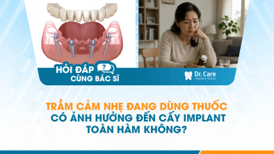 [HỎI ĐÁP BÁC SĨ]: Trầm cảm nhẹ đang dùng thuốc có ảnh hưởng đến cấy Implant toàn hàm không?