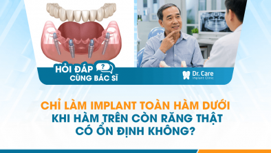 [HỎI ĐÁP BÁC SĨ]: Chỉ làm Implant toàn hàm dưới khi hàm trên còn răng thật có ổn định không?