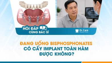 [HỎI ĐÁP BÁC SĨ]: Đang uống Bisphosphonates có cấy Implant toàn hàm được không?