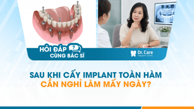[HỎI ĐÁP BÁC SĨ]: SAU KHI CẤY IMPLANT TOÀN HÀM CẦN NGHỈ LÀM MẤY NGÀY?