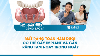 [HỎI ĐÁP BÁC SĨ]: Mất răng toàn hàm dưới có thể cấy Implant và gắn răng tạm ngay trong ngày không?