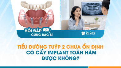 [HỎI ĐÁP BÁC SĨ]: Tiểu đường tuýp 2 chưa ổn định có cấy Implant toàn hàm được không?