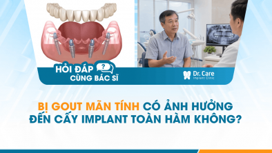 [HỎI ĐÁP BÁC SĨ]: Bị gout mãn tính có ảnh hưởng đến cấy Implant toàn hàm không?