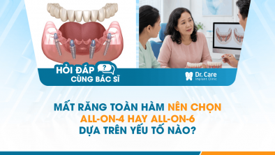 [HỎI ĐÁP BÁC SĨ]: Mất răng toàn hàm nên chọn All-on-4 hay All-on-6 dựa trên yếu tố nào?