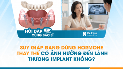 HỎI ĐÁP BÁC SĨ]: Suy giáp đang dùng hormone thay thế có ảnh hưởng đến lành thương Implant không?