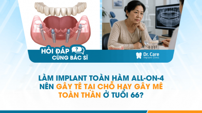 [HỎI ĐÁP BÁC SĨ]: Làm Implant toàn hàm All-on-4 nên gây tê tại chỗ hay gây mê toàn thân ở tuổi 66?
