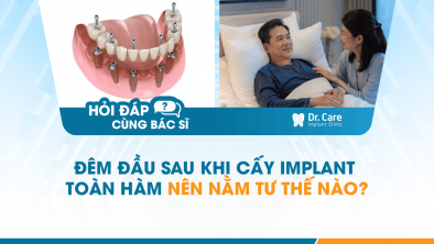 [HỎI ĐÁP BÁC SĨ]: ĐÊM ĐẦU SAU KHI CẤY IMPLANT TOÀN HÀM NÊN NẰM TƯ THẾ NÀO?