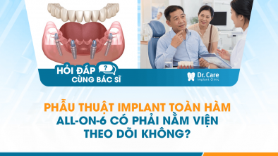[HỎI ĐÁP BÁC SĨ]: PHẪU THUẬT IMPLANT TOÀN HÀM ALL-ON-6 CÓ PHẢI NẰM VIỆN THEO DÕI KHÔNG?