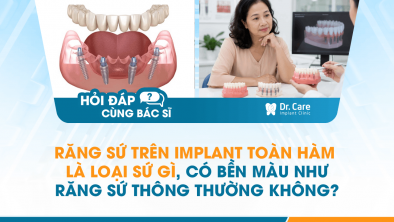 [HỎI ĐÁP BÁC SĨ]: Răng sứ trên Implant toàn hàm là loại sứ gì, có bền màu như răng sứ thông thường không?