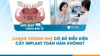 [HỎI ĐÁP BÁC SĨ]: Loãng xương nhẹ có đủ điều kiện cấy Implant toàn hàm không?