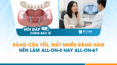 [HỎI ĐÁP BÁC SĨ]: Răng cửa yếu, mất nhiều răng hàm nên làm All-on-4 hay All-on-6?