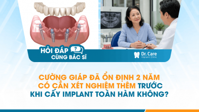 [HỎI ĐÁP BÁC SĨ]: Cường giáp đã ổn định 2 năm có cần xét nghiệm thêm trước khi cấy Implant toàn hàm không?