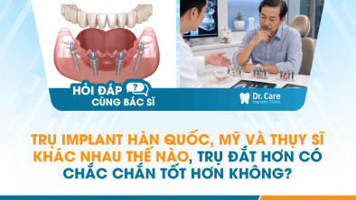 [HỎI ĐÁP BÁC SĨ]: Trụ Implant Hàn Quốc, Mỹ và Thụy Sĩ khác nhau thế nào, trụ đắt hơn có chắc chắn tốt hơn không?