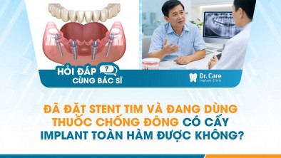 [HỎI ĐÁP BÁC SĨ]: Đã đặt stent tim và đang dùng thuốc chống đông có cấy Implant toàn hàm được không?
