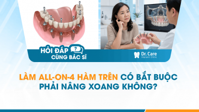 [HỎI ĐÁP BÁC SĨ]: LÀM ALL-ON-4 HÀM TRÊN CÓ BẮT BUỘC PHẢI NÂNG XOANG KHÔNG?
