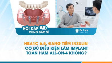 [HỎI ĐÁP BÁC SĨ]: HbA1c 6.5, đang tiêm insulin có đủ điều kiện làm Implant toàn hàm All-on-4 không?