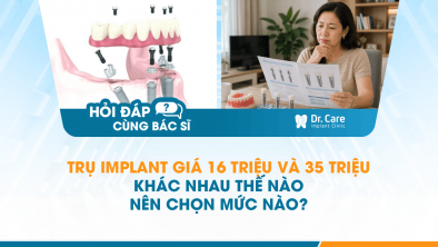 [HỎI ĐÁP BÁC SĨ]: Trụ Implant giá 16 triệu và 35 triệu khác nhau thế nào, nên chọn mức nào?