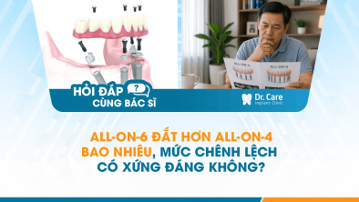 [HỎI ĐÁP BÁC SĨ]: All-on-6 đắt hơn All-on-4 bao nhiêu, mức chênh lệch có xứng đáng không?
