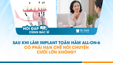 [HỎI ĐÁP BÁC SĨ]: Sau khi làm Implant toàn hàm All-on-6 có phải hạn chế nói chuyện, cười lớn không?