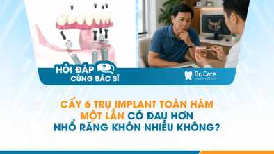 [HỎI ĐÁP BÁC SĨ]: Cấy 6 trụ Implant toàn hàm một lần có đau hơn nhổ răng khôn nhiều không?