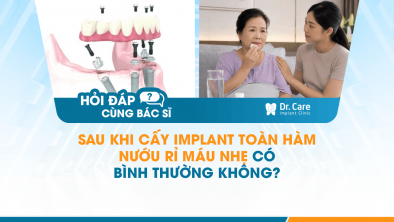 [HỎI ĐÁP BÁC SĨ]: SAU KHI CẤY IMPLANT TOÀN HÀM, NƯỚU RỈ MÁU NHẸ CÓ BÌNH THƯỜNG KHÔNG?