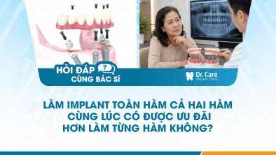 [HỎI ĐÁP BÁC SĨ]: Làm Implant toàn hàm cả hai hàm cùng lúc có được ưu đãi hơn làm từng hàm không?