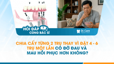 [HỎI ĐÁP BÁC SĨ]: Chia cấy từng 2 trụ thay vì đặt 4–6 trụ một lần có đỡ đau và mau hồi phục hơn không?