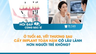 [HỎI ĐÁP BÁC SĨ]: Ở tuổi 60, vết thương sau cấy Implant toàn hàm có lâu lành hơn người trẻ không?