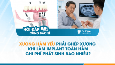 [HỎI ĐÁP BÁC SĨ]: Xương hàm yếu phải ghép xương khi làm Implant toàn hàm, chi phí phát sinh bao nhiêu?