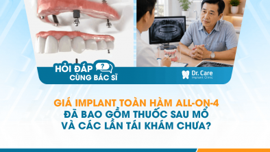 [HỎI ĐÁP BÁC SĨ]: Giá Implant toàn hàm All-on-4 đã bao gồm thuốc sau mổ và các lần tái khám chưa?
