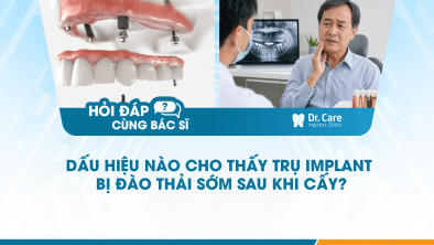 [HỎI ĐÁP BÁC SĨ]: Dấu hiệu nào cho thấy trụ Implant bị đào thải sớm sau khi cấy?
