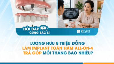 [HỎI ĐÁP BÁC SĨ]: Lương hưu 8 triệu đồng, làm Implant toàn hàm All-on-4 trả góp mỗi tháng bao nhiêu?