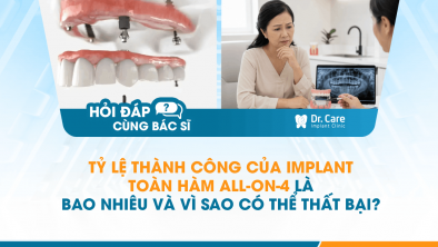 [HỎI ĐÁP BÁC SĨ]: Tỷ lệ thành công của Implant toàn hàm All-on-4 là bao nhiêu và vì sao có thể thất bại?