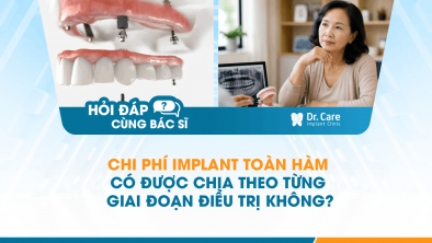 [HỎI ĐÁP BÁC SĨ]: Chi phí Implant toàn hàm có được chia theo từng giai đoạn điều trị không?