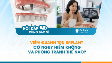 [HỎI ĐÁP BÁC SĨ]: Viêm quanh trụ Implant có nguy hiểm không và phòng tránh thế nào?