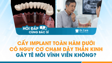 [HỎI ĐÁP BÁC SĨ]: Cấy Implant toàn hàm dưới có nguy cơ chạm dây thần kinh gây tê môi vĩnh viễn không?