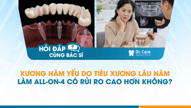 [HỎI ĐÁP BÁC SĨ]: Xương hàm yếu do tiêu xương lâu năm làm All-on-4 có rủi ro cao hơn không?