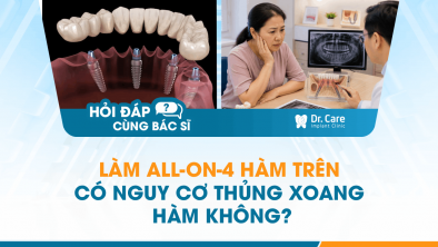 [HỎI ĐÁP BÁC SĨ]: Làm All-on-4 hàm trên có nguy cơ thủng xoang hàm không?