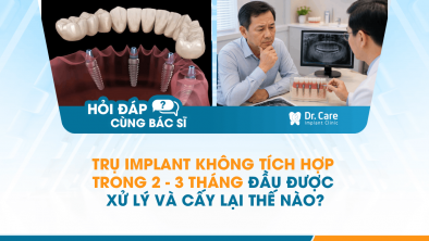 [HỎI ĐÁP BÁC SĨ]: Trụ Implant không tích hợp trong 2–3 tháng đầu được xử lý và cấy lại thế nào?