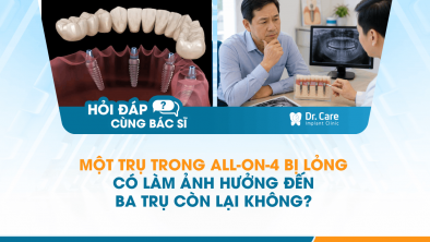 [HỎI ĐÁP BÁC SĨ]: Một trụ trong All-on-4 bị lỏng có làm ảnh hưởng đến ba trụ còn lại không?