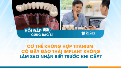 [HỎI ĐÁP BÁC SĨ]: Cơ thể không hợp titanium có gây đào thải Implant không, làm sao nhận biết trước khi cấy?