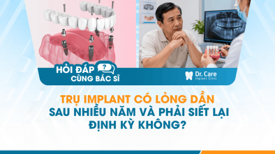 [HỎI ĐÁP BÁC SĨ]: Trụ Implant có lỏng dần sau nhiều năm và phải siết lại định kỳ không? 