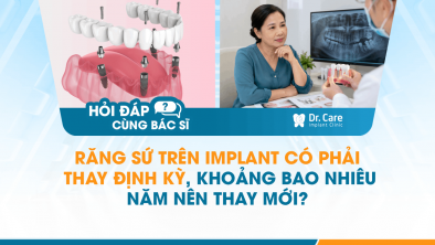 [HỎI ĐÁP BÁC SĨ]: Răng sứ trên Implant có phải thay định kỳ, khoảng bao nhiêu năm nên thay mới?