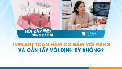 [HỎI ĐÁP BÁC SĨ]: Implant toàn hàm có bám vôi răng và cần lấy vôi định kỳ không?